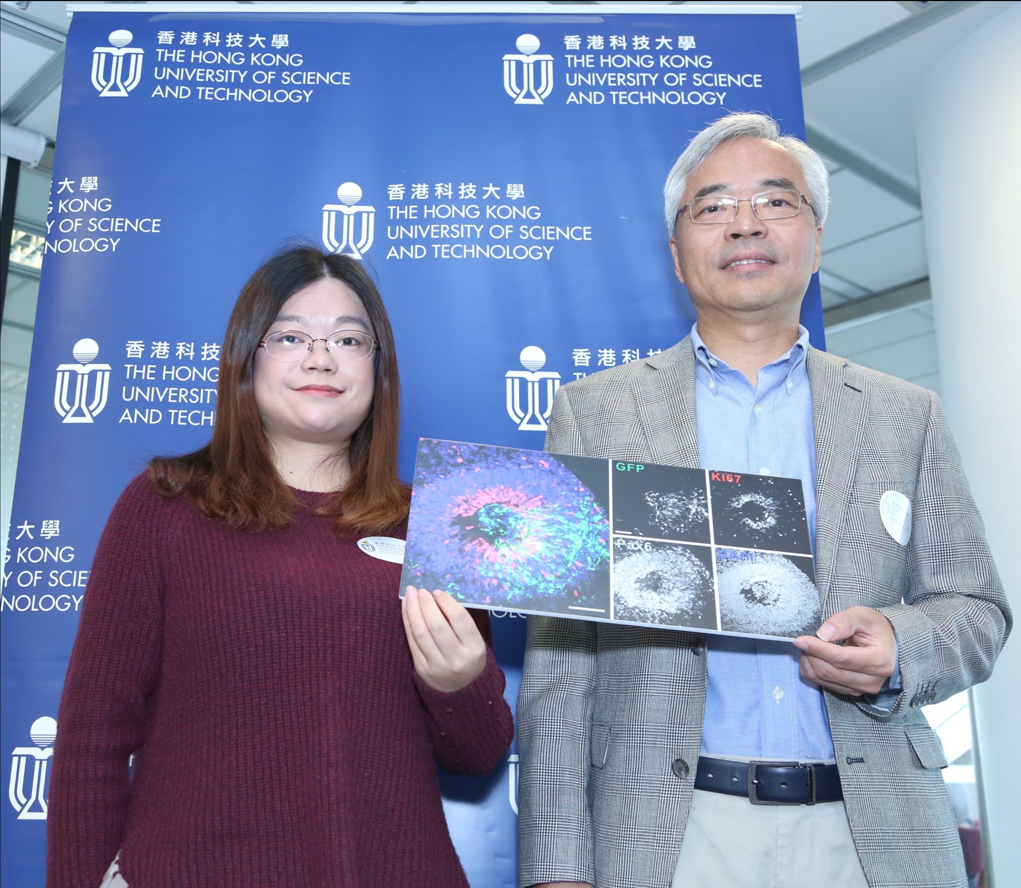  张明杰教授 (右) 与叶菲教授利用由精神分裂症患者细胞构建出来的模拟人脑进行实验