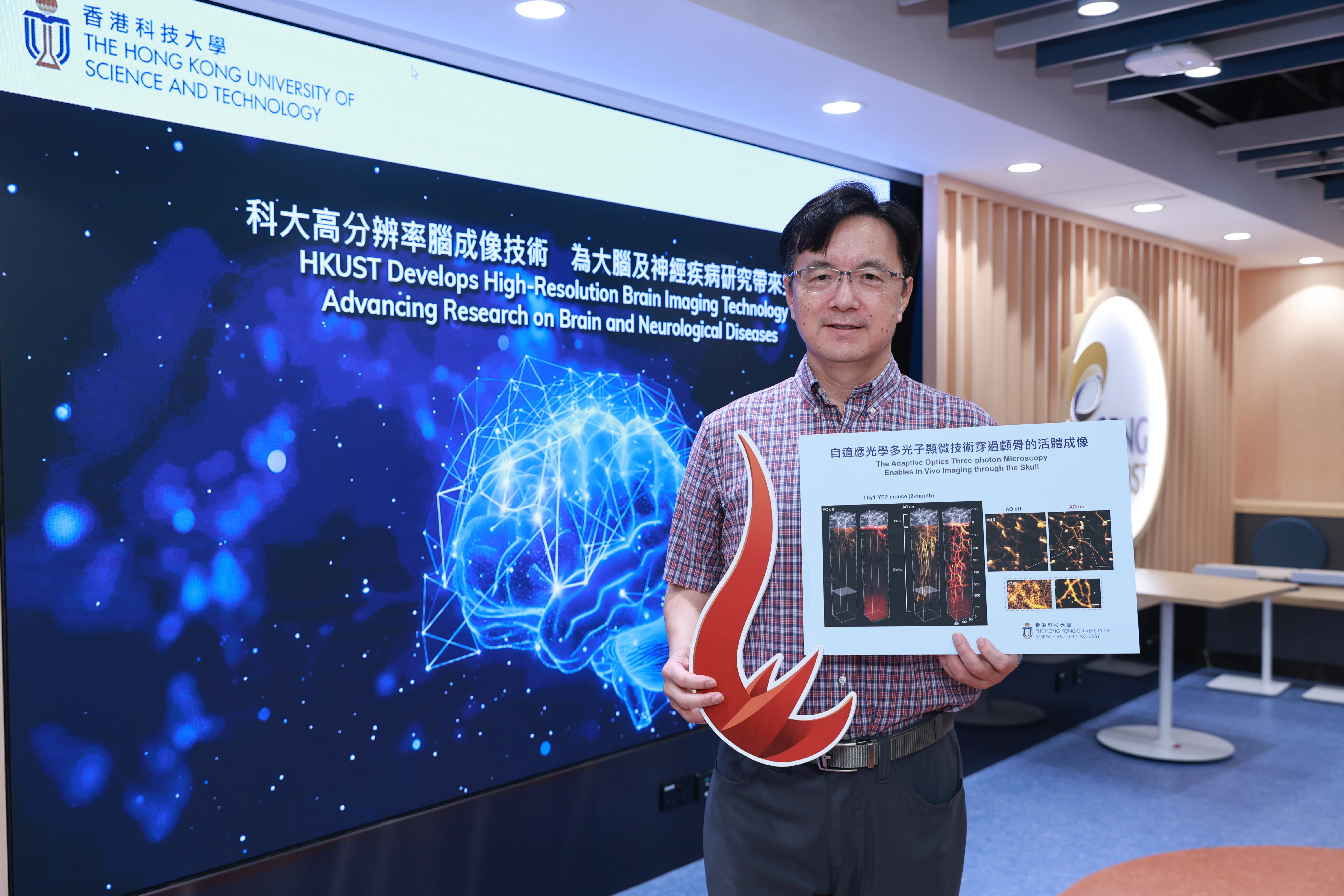 A research team led by Prof. QU Jianan, Professor of the HKUST Department of Electronic and Computer Engineering of the School of Engineering, has introduced a groundbreaking technique that can capture high-resolution images of the awake mice brain in a near non-invasive manner. The advancement promises deeper insights into human brain function in both healthy and diseased conditions.