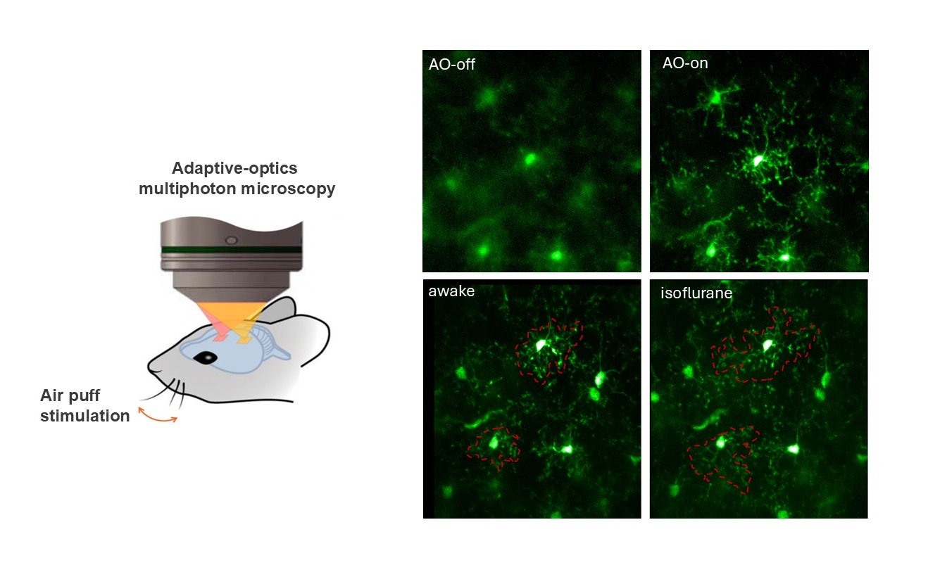 The upper right image illustrates how adaptive optics three-photon microscopy enables high-resolution imaging of microglia in the brains of awake mice, resulting in clearer images compared to existing technologies. The lower left image demonstrates that this new technology can capture microglia activity in mice in awake state. This will help scientists in understanding the progression of neurological diseases such as Alzheimer's disease.